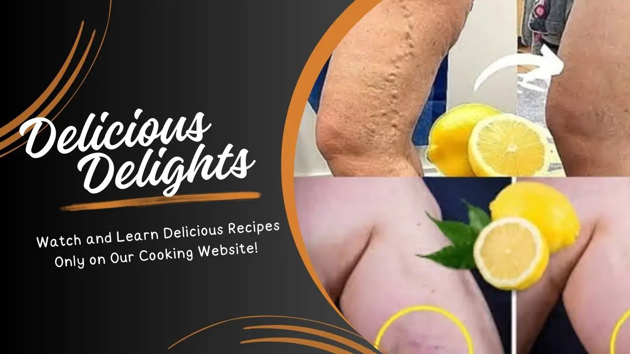 Natural Remedy for Varicose Veins How Lemon Helps Improve Circulation and Reduce Swelling